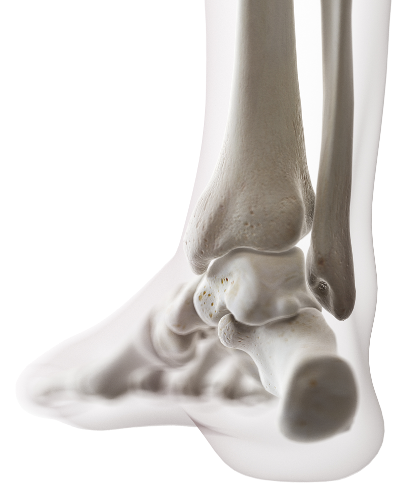 What is Ankle Instability? Symptoms, Causes, Diagnosis